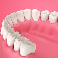 Gum Disease Edinburg, TX