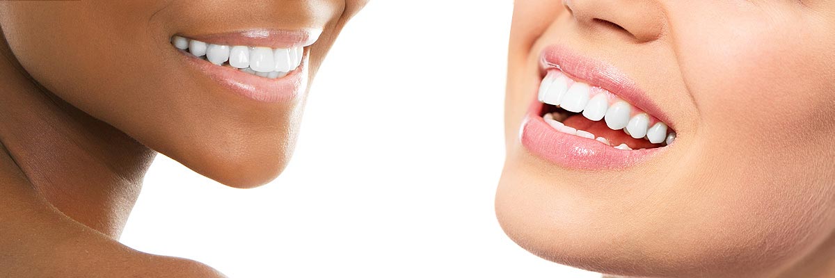 Edinburg Teeth Whitening