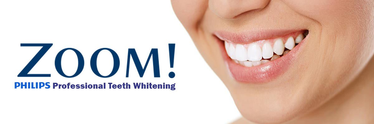 Edinburg Zoom Teeth Whitening